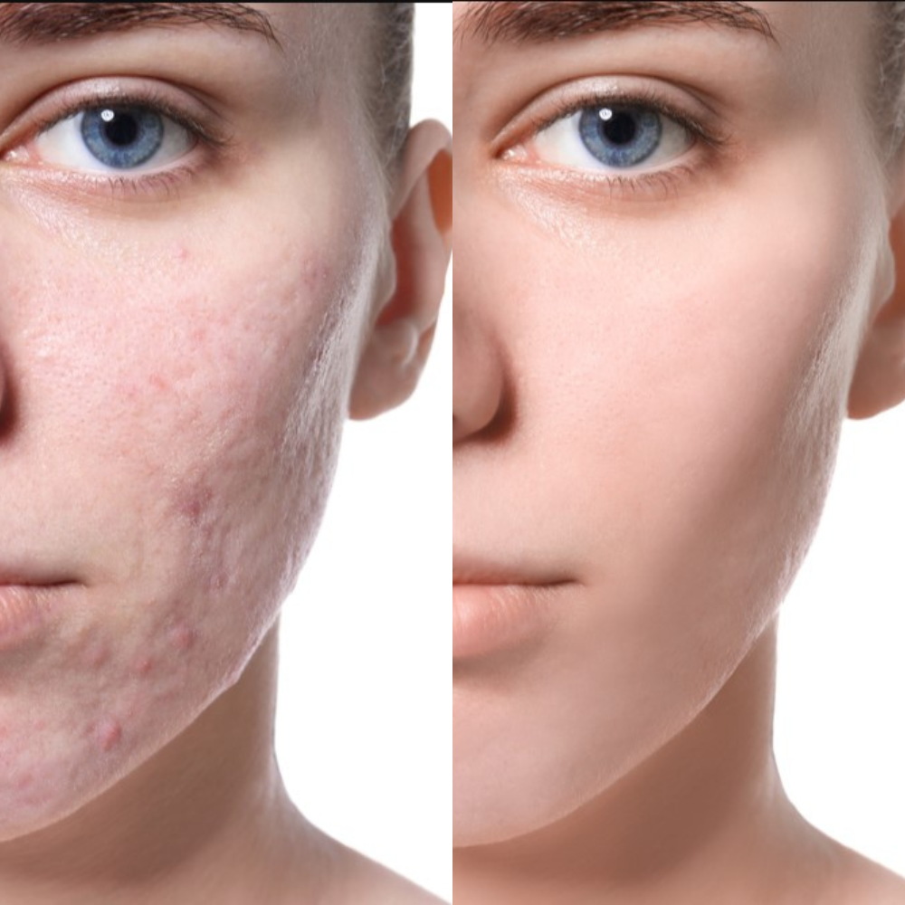 Gentle Double-Sided Facial Cleanser for Smooth Glowing Skin